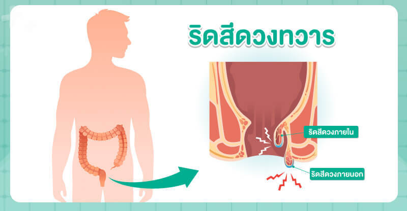 ดวงรายเดือนราศีมังกร 2568 เสริมดวงด้านความงาม อ่อนเยาว์